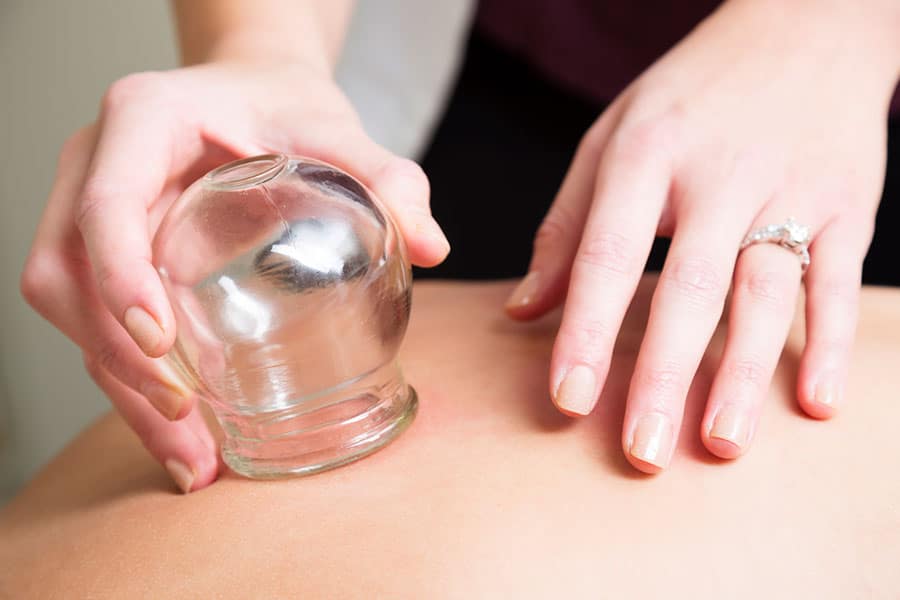 Cupping Therapy in Warren, Michigan